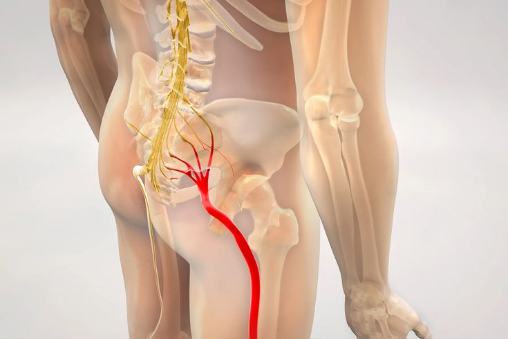 Sciatica Nerve